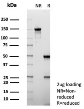 S100P Antibody