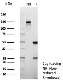 S100P Antibody