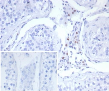 NR5A1 Antibody