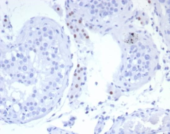 NR5A1 Antibody