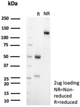 NR5A1 Antibody