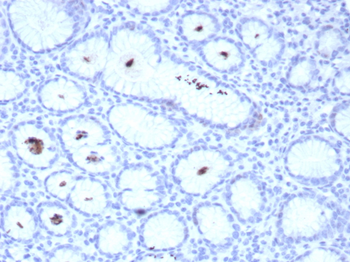 Recombinant Helicobacter pylori (Catalase) Antibody