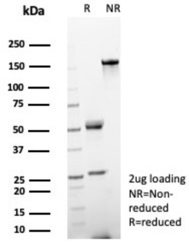 Recombinant Helicobacter pylori (Catalase) Antibody