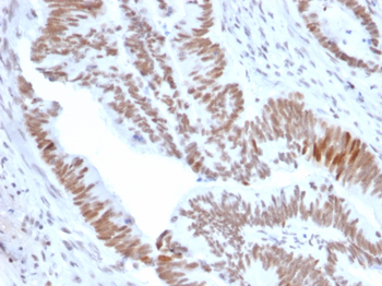 CCAR2 Antibody