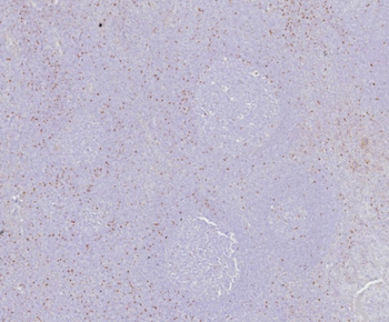 FOXP3 Antibody