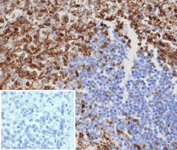 STING1 Antibody