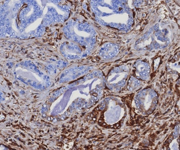 STING1 Antibody