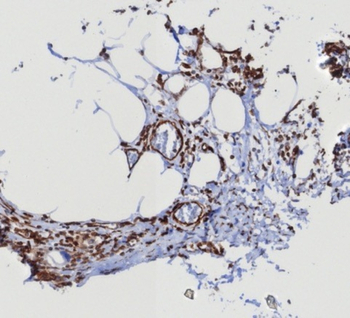 STING1 Antibody