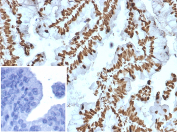 ZNF846 Antibody
