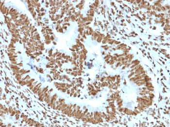 ZNF846 Antibody