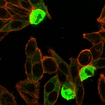ZNF846 Antibody