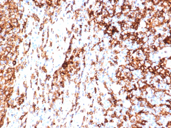 HLA-DRA Antibody