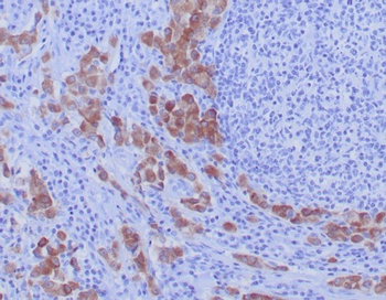 ROS1 Antibody