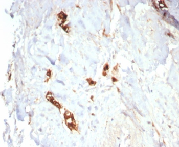 SCGB2A2 Antibody