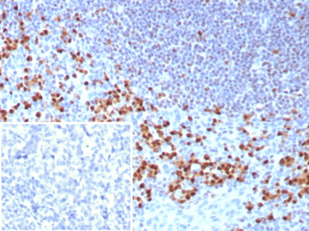 IRF4 Antibody