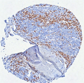 IRF4 Antibody
