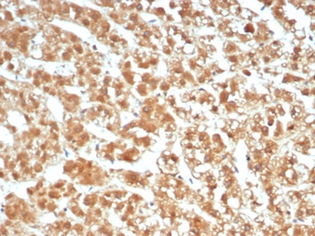 IL1B Antibody