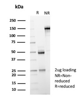 IL1B Antibody