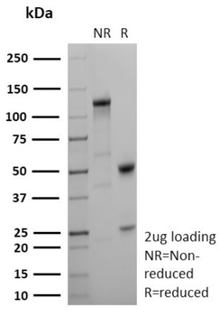 Recombinant Lewis Y (Tumor Marker) Antibody