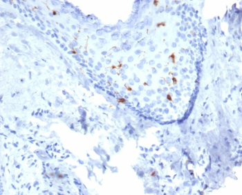 CD207 Antibody