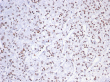 SMARCAL1 Antibody