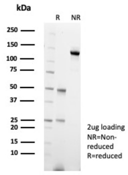 CARM1 Antibody