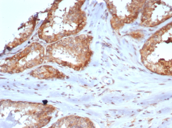 CARM1 Antibody