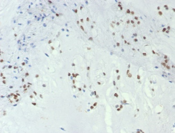 TBXT Antibody