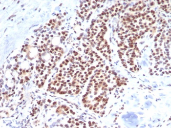 TBXT Antibody