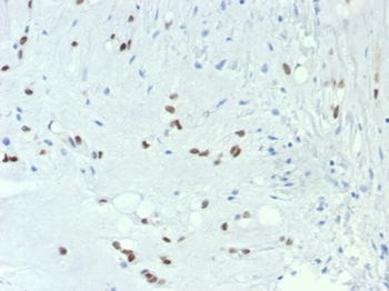 TBXT Antibody