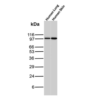 STAT6 Antibody