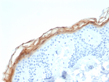 KLK7 Antibody