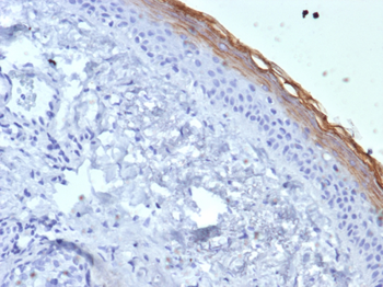 KLK7 Antibody