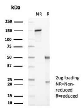 SERPINA1 Antibody
