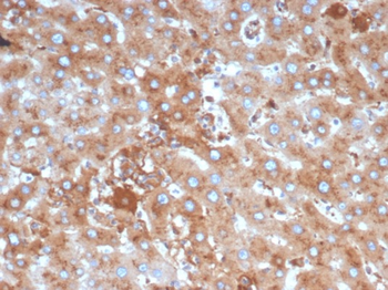 SERPINA1 Antibody