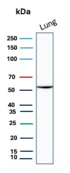 SERPINA1 Antibody