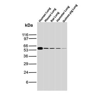 SERPINA1 Antibody
