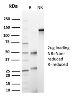 SERPINA1 Antibody