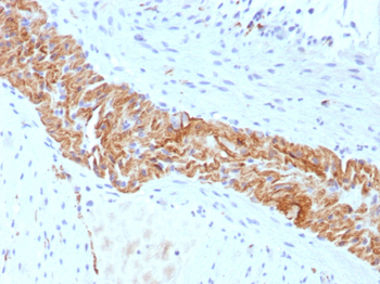 NCAM1 Antibody