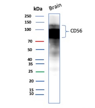 NCAM1 Antibody