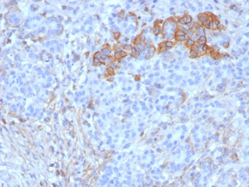 CD99 Antibody