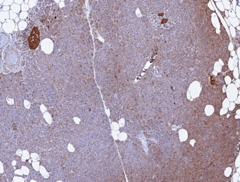 CD99 Antibody