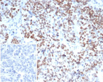 MEIS2 Antibody