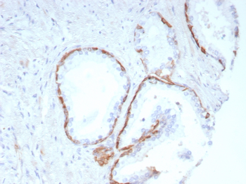 KRT14 Antibody