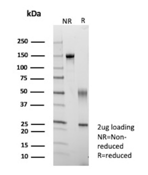 KRT14 Antibody