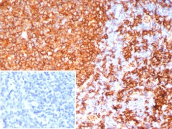 HLA-DRB1 Antibody