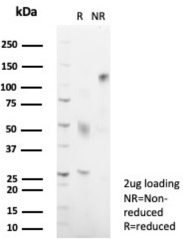 HLA-DRB1 Antibody