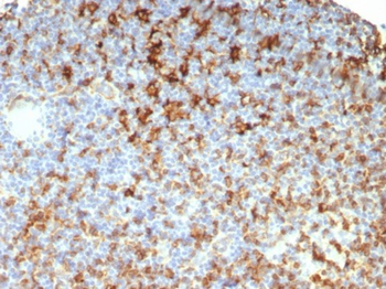 HLA-DRB1 Antibody