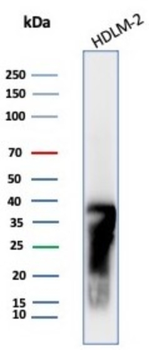 HLA-DRB1 Antibody