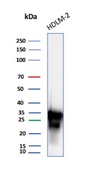 HLA-DRB1 Antibody